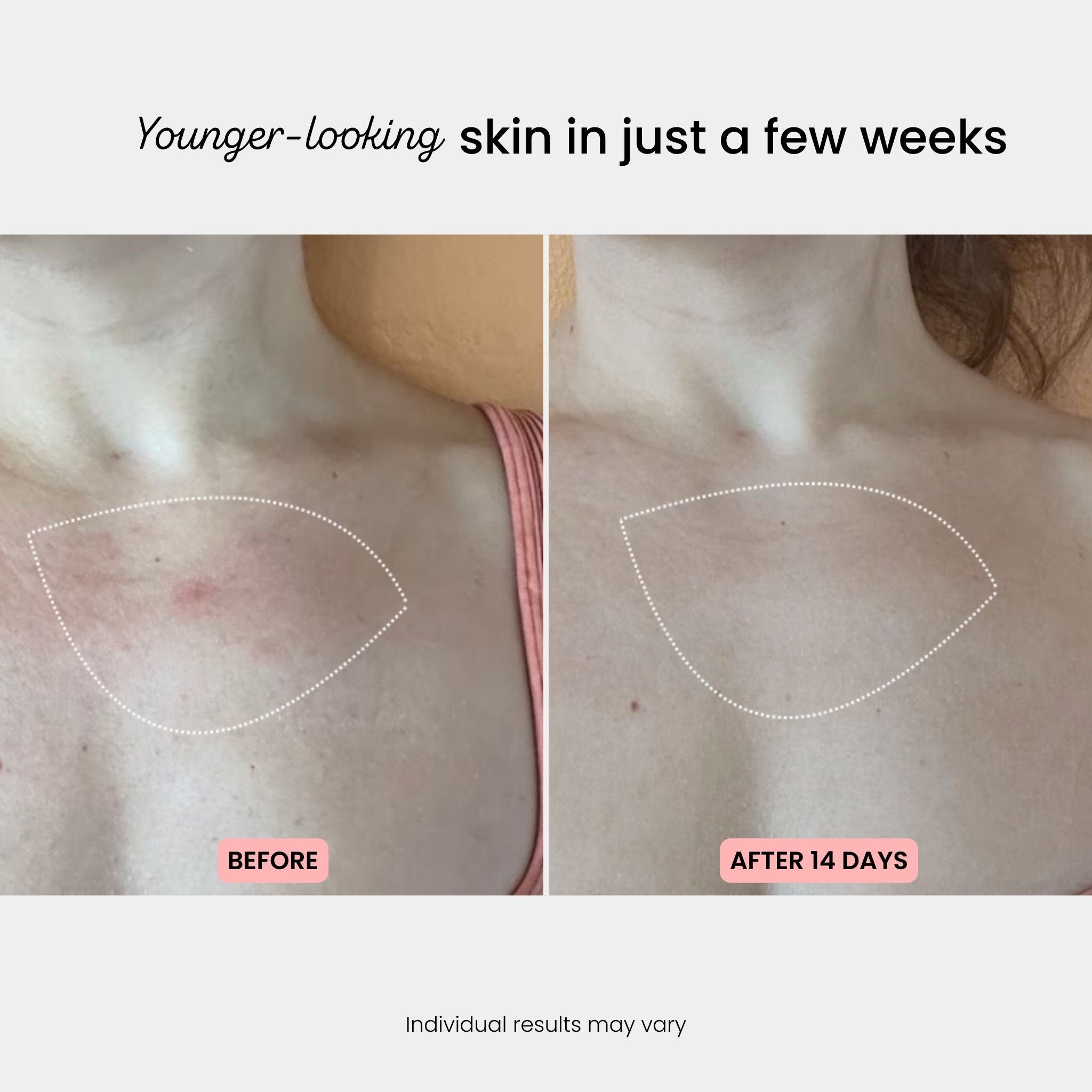 Neck & Décolleté Sculpt