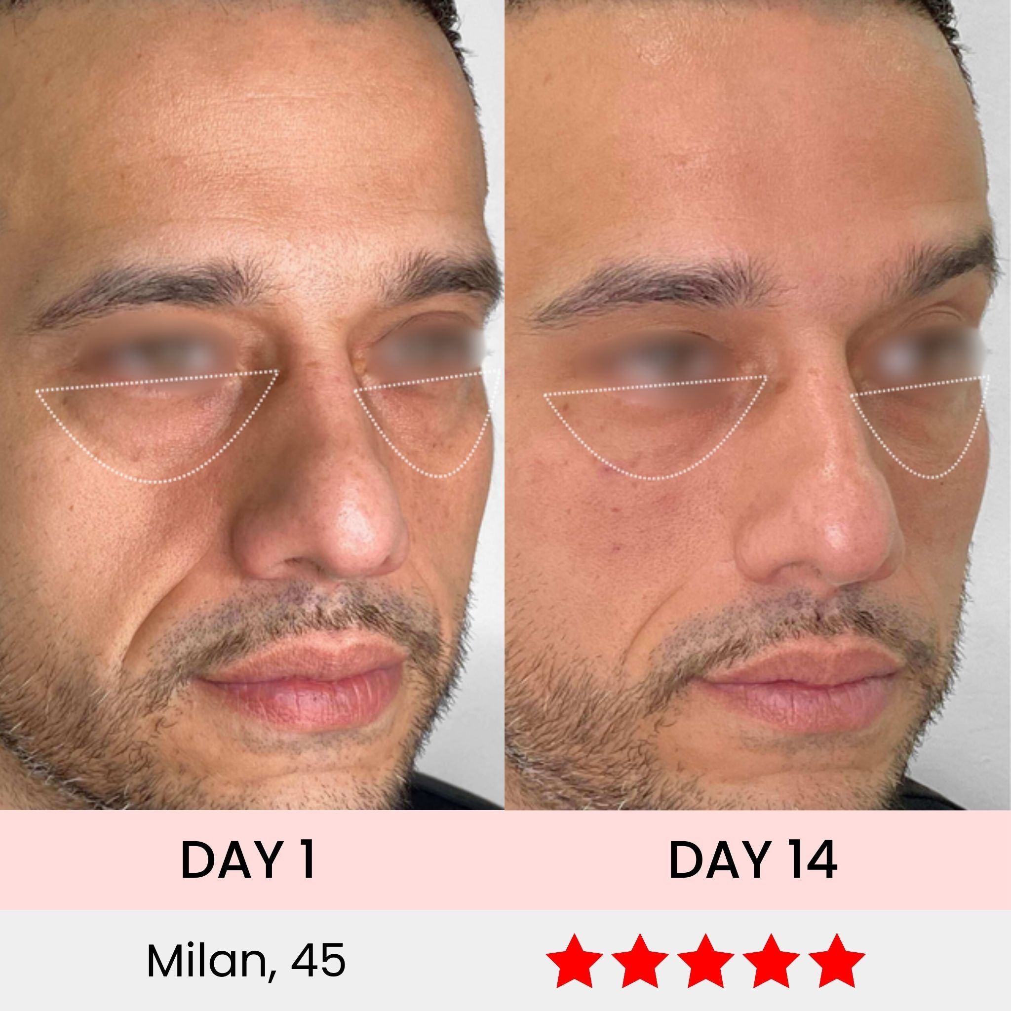 EyeSculpt Pro